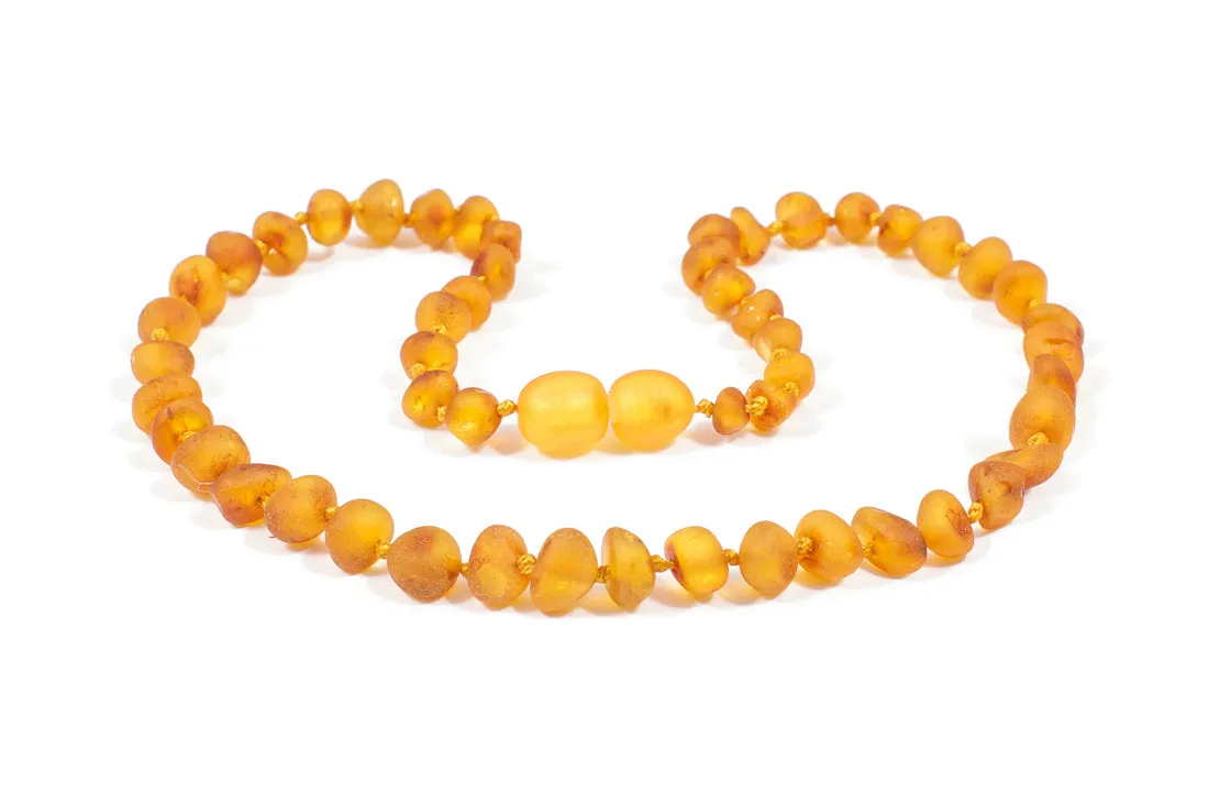 RAW AMBER TEETHING NECKLACE & BRACELET FOR CHILDREN / HONEY COLOUR / UNPOLISHED / EXTRA SAFE & EFFECTIVE